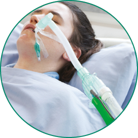 active humidification invasive ventilation