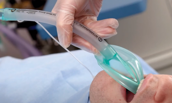 The Intersurgical laryngeal mask range